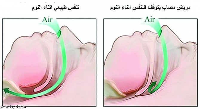 اضطرابات النوم.. تؤثر في القلب ووظائفه وراحة الجسم