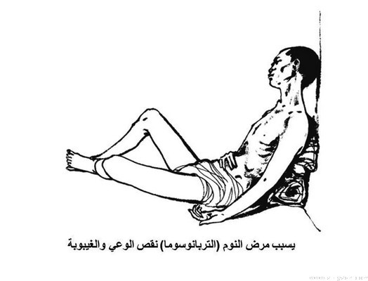 مرض النوم الأفريقي... داء يصيب الجهاز العصبي